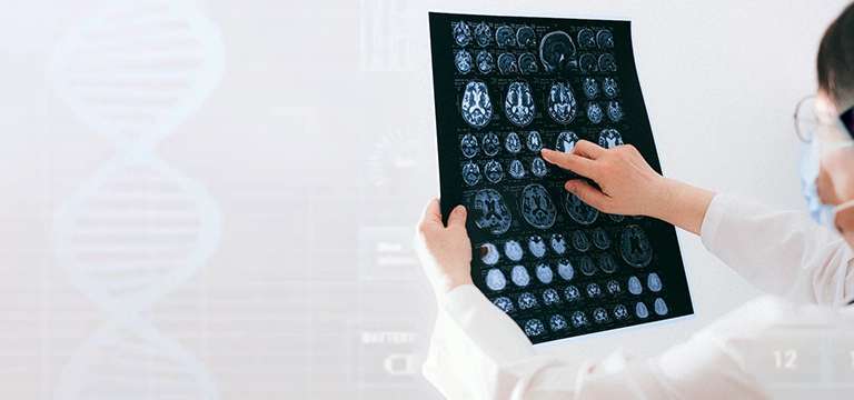 A Comprehensive Guide to MRI Brain Scan Prices